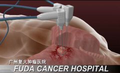 ��CCC��ģʽ�ΰ�֢