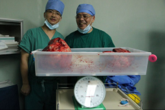 广州：“大肚女孩”成功摘瘤创奇迹 肿瘤重达30斤