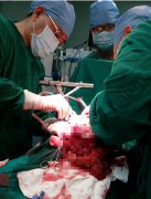 �����ҽ�����Ϊ��ǻ�޴��\ɫ�������ߵ���������