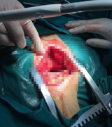 ���ݸ�������ҽԺ���������䶳������������֮· ������������ҽԺ��