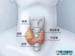 ��״�١���ڡ��ǰ���? �㲻��̯�ϴ���?