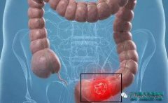 ̨���������򳦰�ȥ�����쿴������Щ��ȺҪ����������ɸ��?