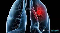 ר�ҽ����ΰ�������ת����ʲô֢״����ô���ƣ�