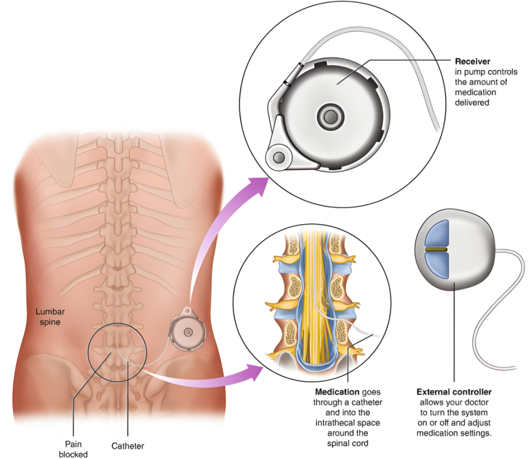 С���ơ�ʹ���֣�Ժ������������ʹ�ã�Ϊ��ʹ���߾�׼ֹʹ