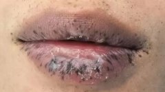 ���Ӵ��ܺڰ߲��200��ų�Ϣ�⣬Ԫ�׾����Ŵ�