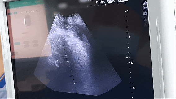 �ŵ�2.gif