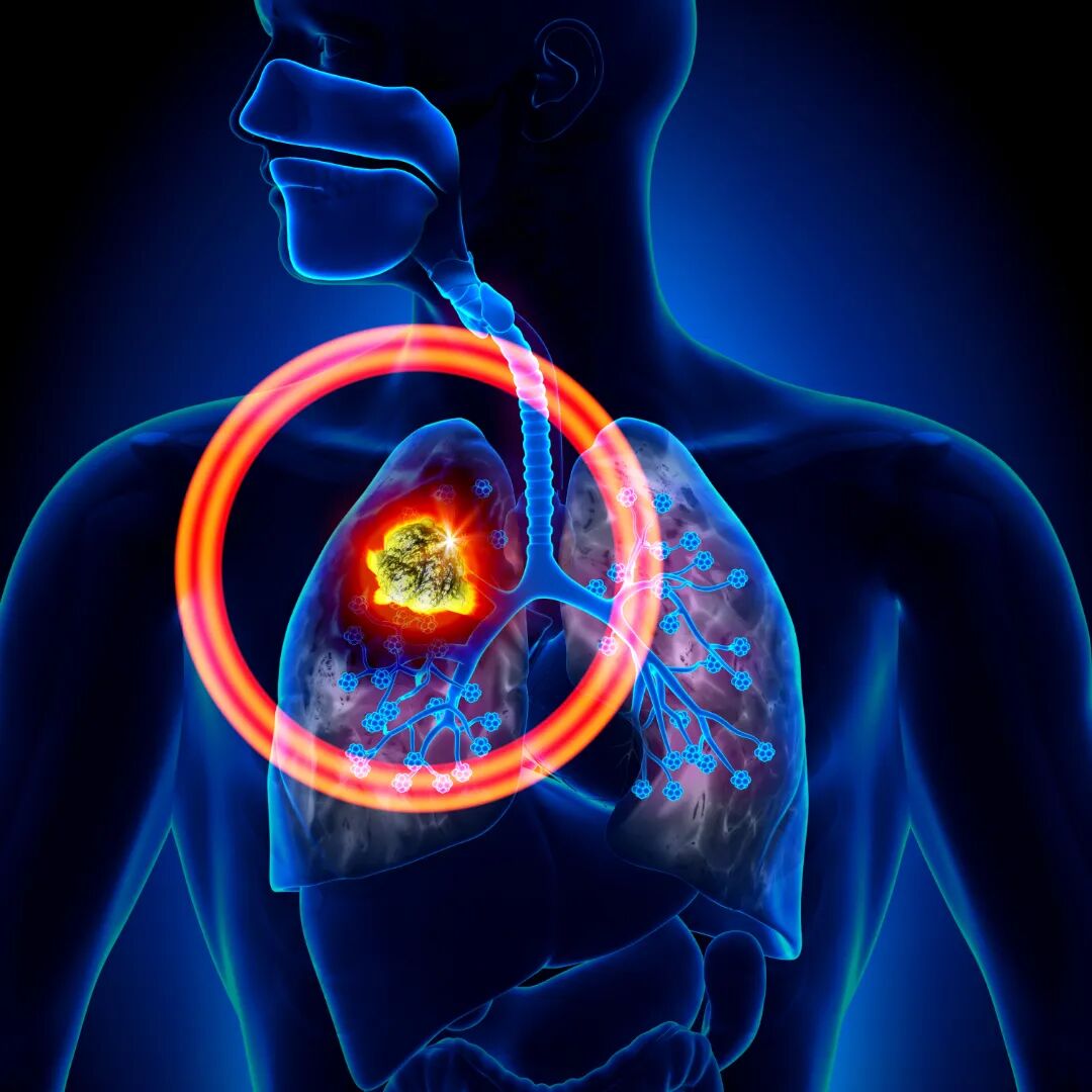 pki124708.jpg