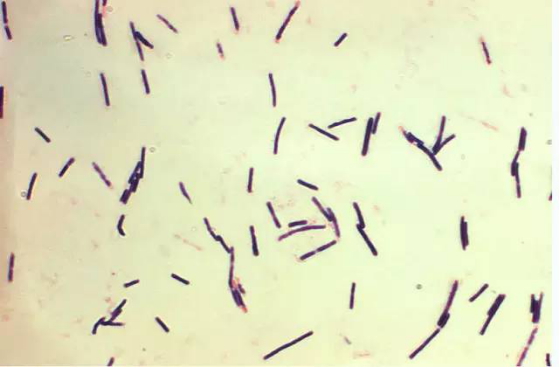 破伤风杆菌芽孢形态图片